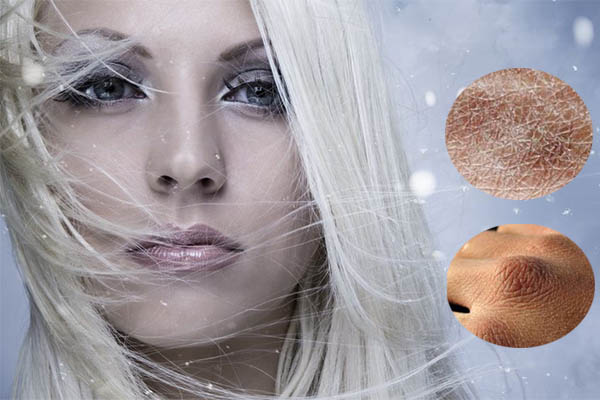 dry_skin_1