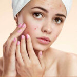 Набір олій Nefertiti по догляду за шкірою, схильної до акне - Зображення 2